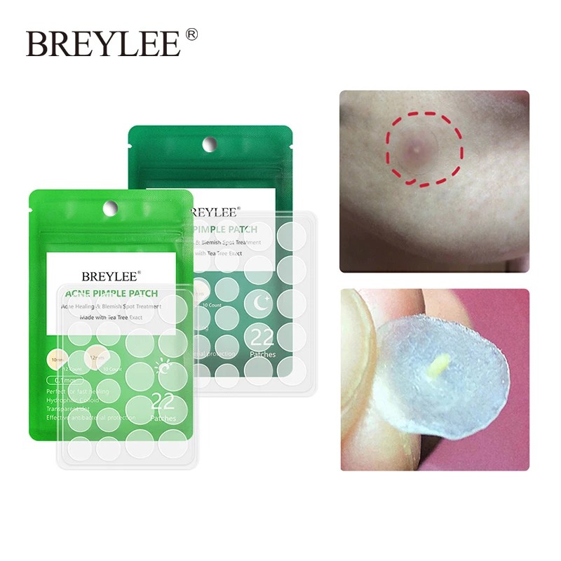 BREYLEE 22 Miếng Dán Hỗ Trợ Giảm Mụn Sử Dụng Hàng Ngày Miếng/Gói  Loại bỏ mụn đầu đen