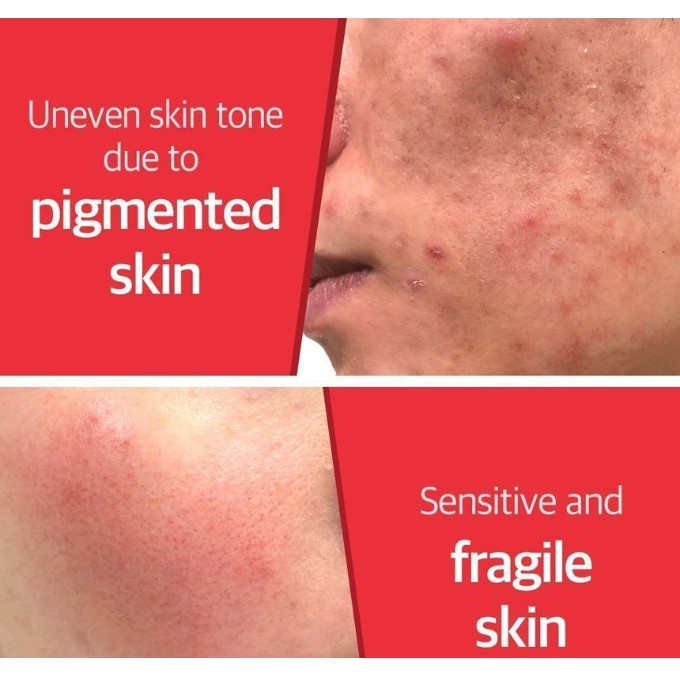 [Hàng mới về] Bộ 4 sản phẩm dưỡng da SOME BY MI tinh chất ốc sên truecica gồm toner/serum/sữa rửa mặt/kem (có bán lẻ)