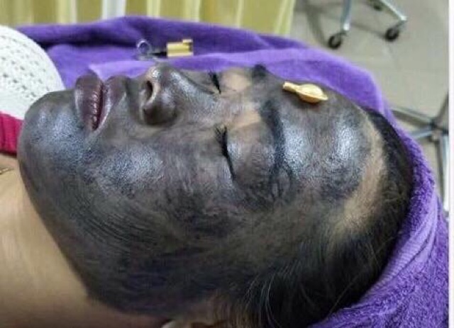 VIÊN THẢI CHÌ VÀ ĐỘC TỐ BẰNG ĐỒNG BẠC PEONY WHITE