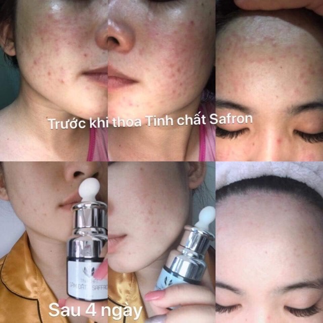 Tinh Chất Sâm Đất Saffron - Tinh Chất Saffron Dr Cell 20ml