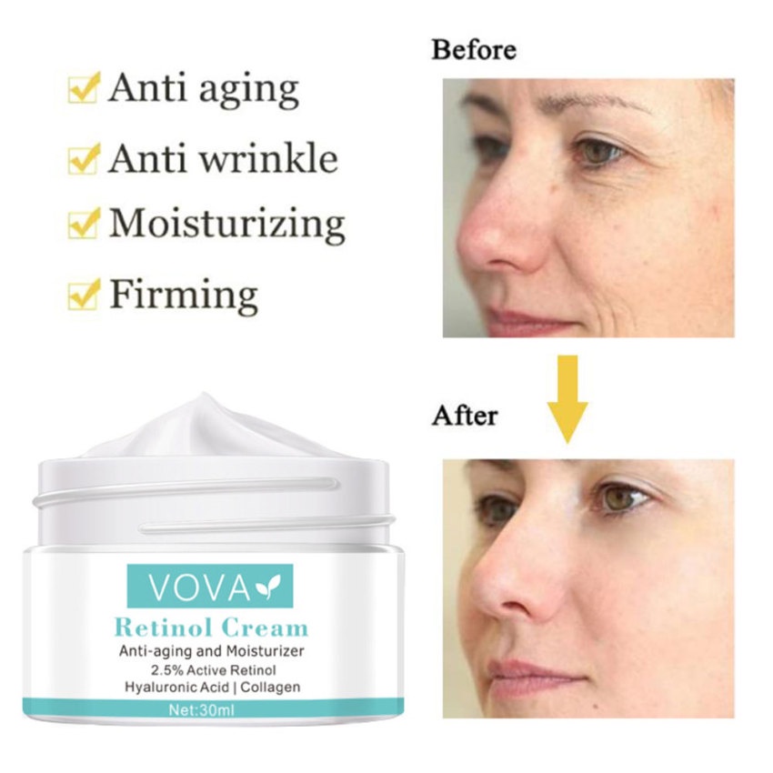 Kem Dưỡng Da Mặt Retinol Giữ Ẩm Làm Trắng Chống Nếp Nhăn Và Đốm Đen 30ml