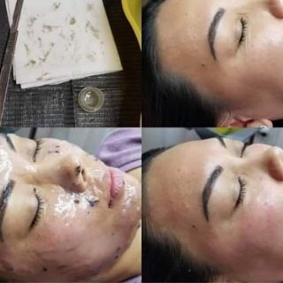 Mặt nạ esthemax