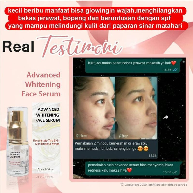 (Hàng Mới Về) Serum Trị Mụn Làm Trắng Da Chống Lão Hóa Và Sẹo