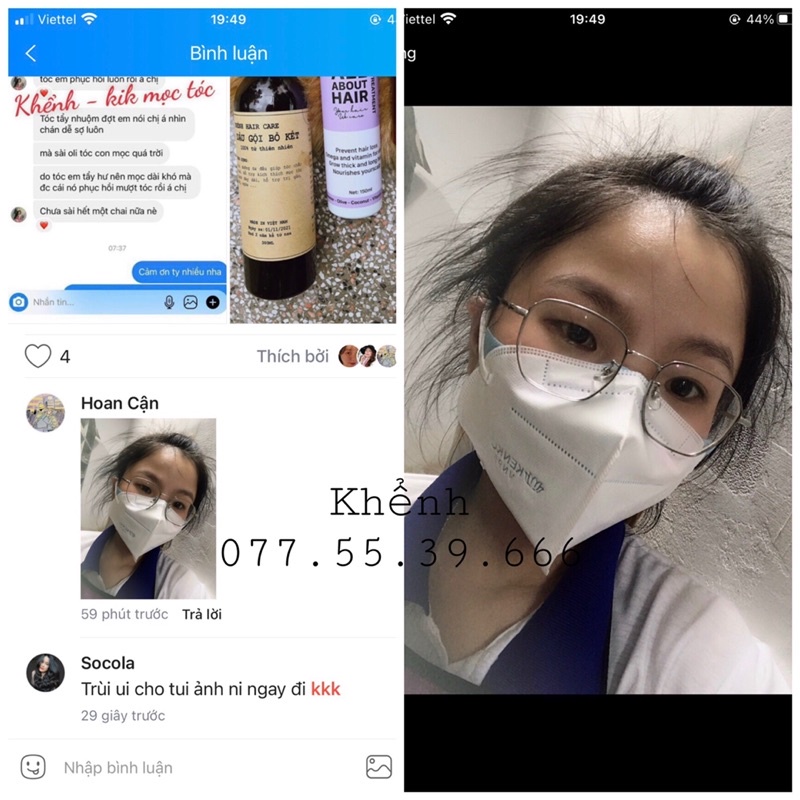 Dầu Ủ Oil Treatment Mọc Tóc Nhanh Dày Dài