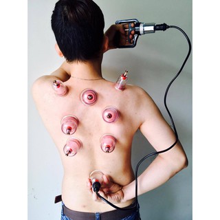 Bộ giác hơi không dùng lửa E kèm dây nối