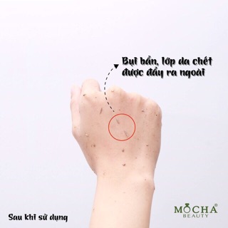 TẨY TẾ BÀO CHẾT CAFE DỪA MOCHA
