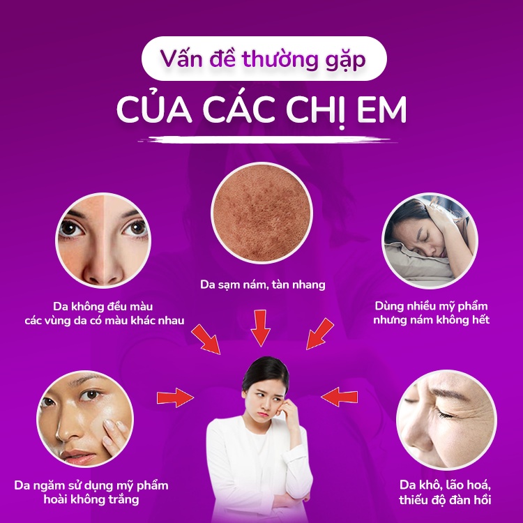 Oriskin Oribeauty 45 Viên ❤️[ CHÍNH HÃNG ] ❤️ Viên Uống Trắng Da Mờ Nám Và Tàn Nhang