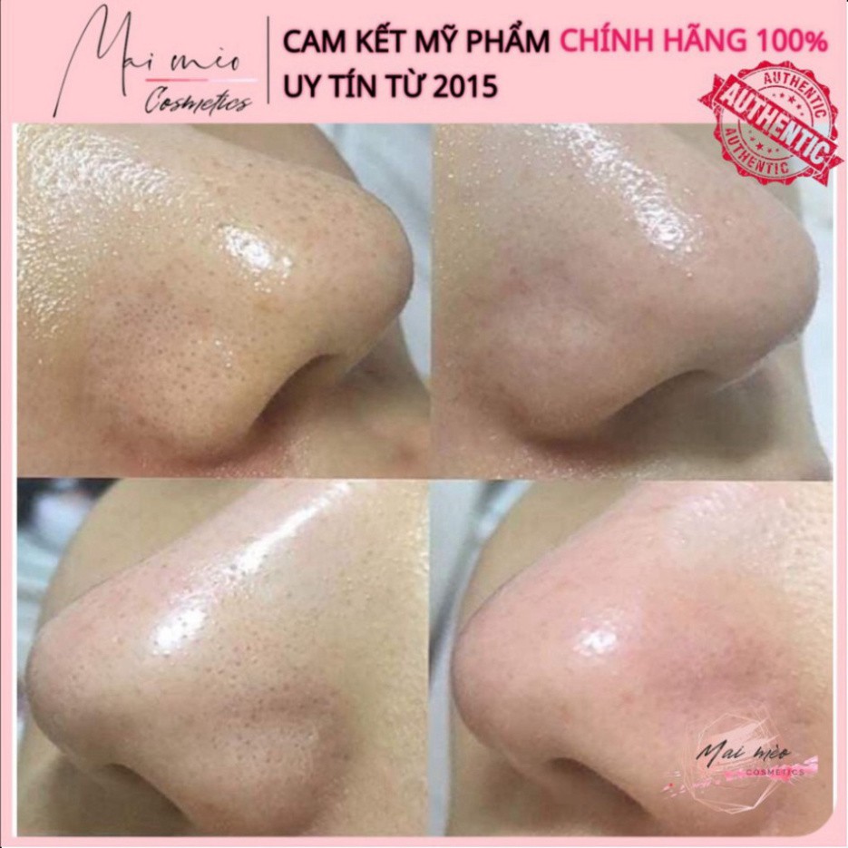  Ủ Mụn Medi-Peel Extra Super9- Mụn Cám Mụn Đầu Đen, Mụn Cám | BigBuy360 - bigbuy360.vn