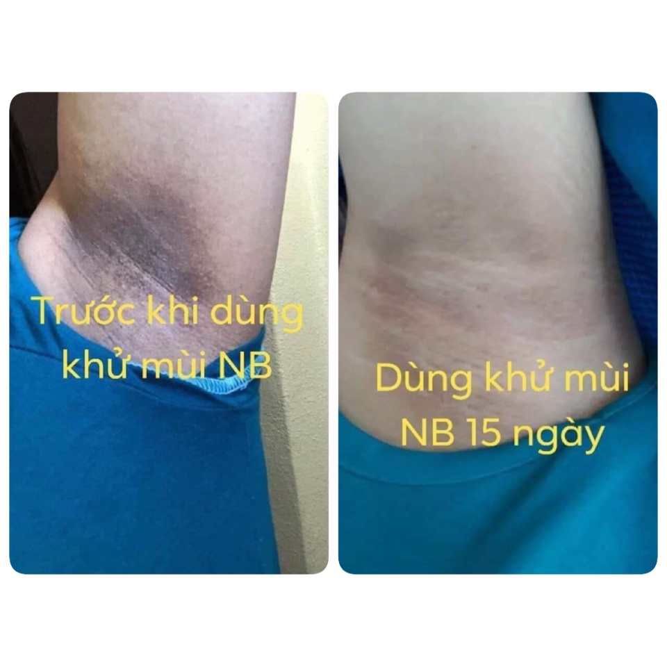 Hôi nách ngân bình chính hãng