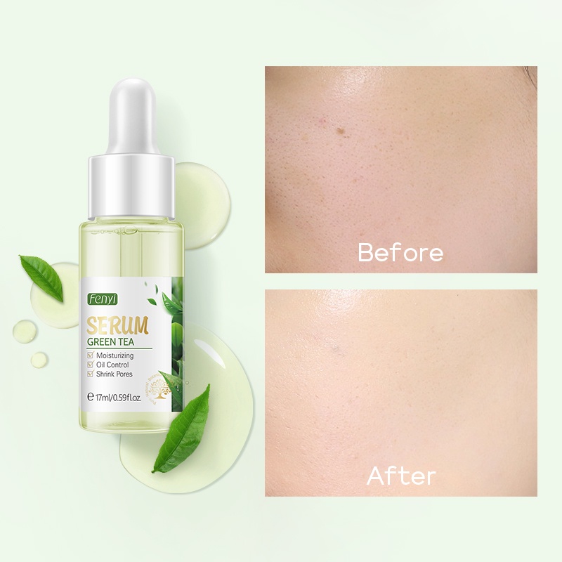 Serum trà xanh Fenyi LAIKOU làm dịu mịn màng thu nhỏ lỗ chân lông bật tông trắng sáng cho làn da 17ml