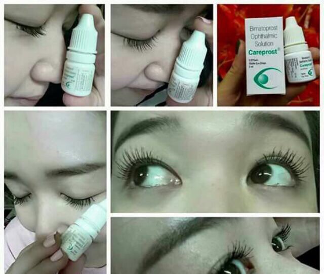 DƯỠNG DÀI MI CAREPROST ẤN ĐỘ - CHÍNH HÃNG | BigBuy360 - bigbuy360.vn