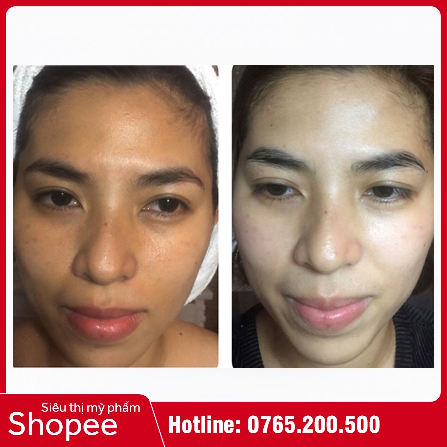 Kem Trắng Da Mặt Medi White - Medi White Face - Trắng Da, Ngừa Sạm Nám, Tàn Nhang | BigBuy360 - bigbuy360.vn