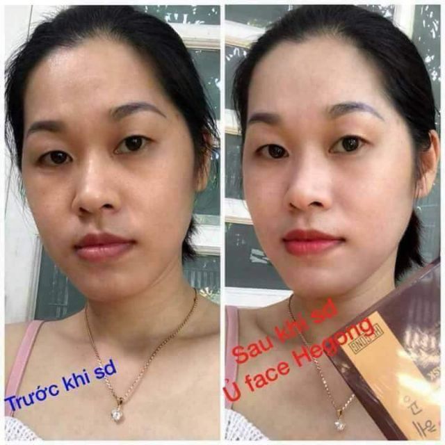 Ủ face  & khóa trắng hegong