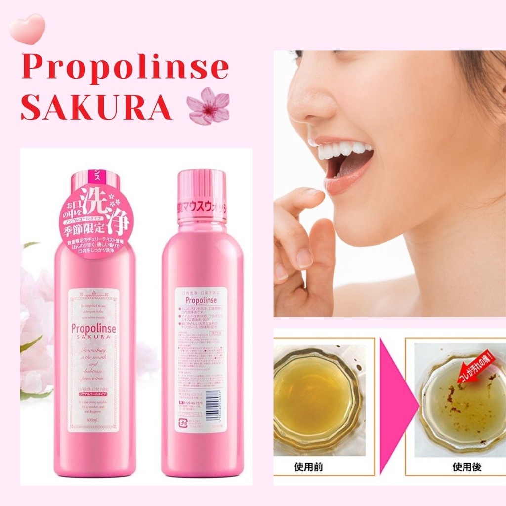 Nước súc miệng Propolinse chai 600ml đủ 5 loại - Nhật Bản