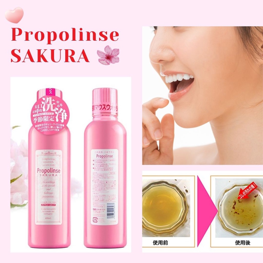 Nước súc miệng Propolinse chai 600ml đủ 5 loại - Nhật Bản | BigBuy360 - bigbuy360.vn