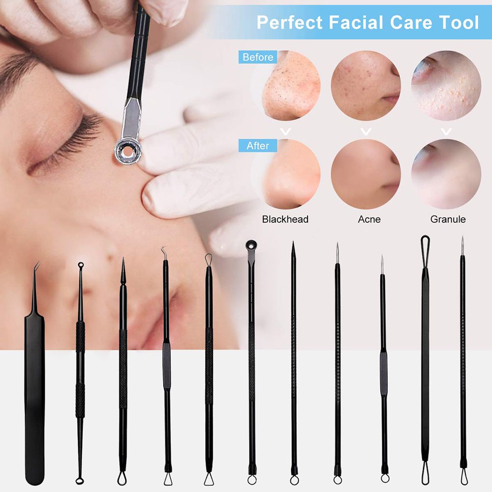 [Hàng mới về] Set dụng cụ loại bỏ mụn đầu đen hai đầu bằng thép không gỉ chăm sóc da có hộp đựng dành cho nữ
