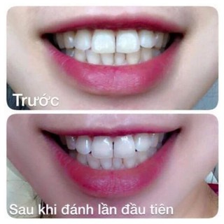 💎 [ CHÍNH HÃNG ] Kem Đánh Sạch Trắng Răng Eucryl Toothpaste 💧