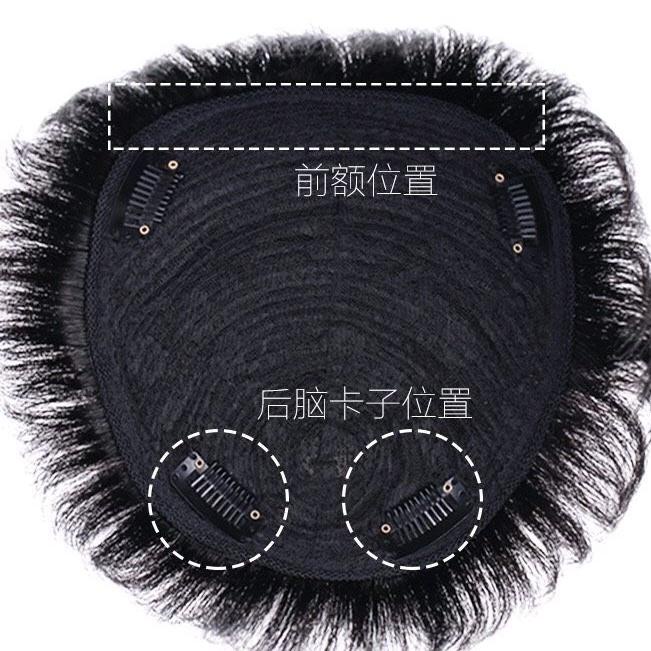 Tóc Giả Che Hói Cho Nam Phong Cách Trẻ Trung QiQiShop