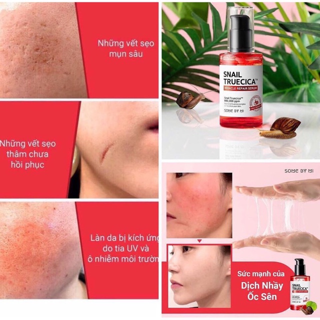 Combo Serum + Kem Dưỡng Phục Hồi Da Some By Mi Snail Truecica Fullsize