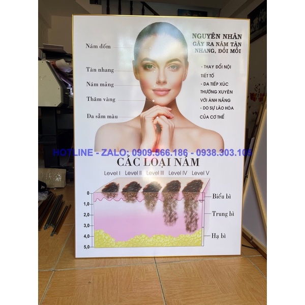 TRANH SPA CHĂM SÓC DA MỤN - NÁM - TÀN NHANG CHO SPA