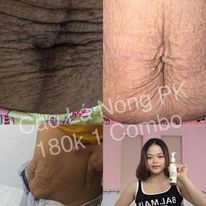 Tan mỡ gia truyền Cao Lá Nóng - PK