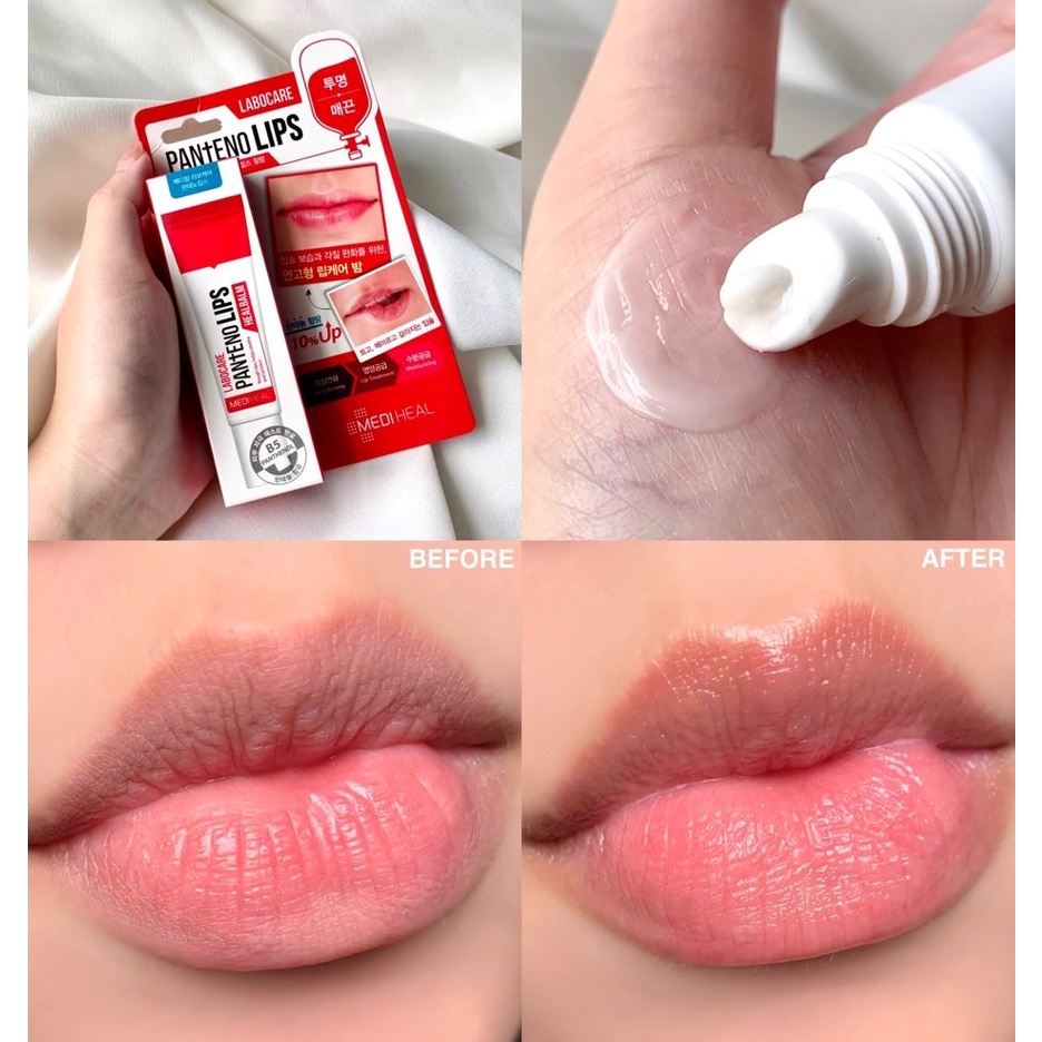 Son Dưỡng Giảm Thâm Môi Mediheal Labocare Panteno Lips - 10ml