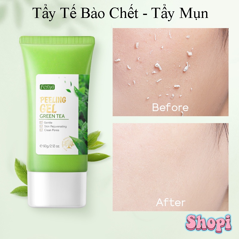 Gel Tẩy tế bào chết Fenyi chiết xuất trà xanh tẩy mụn đầu đen làm sạch lỗ chân lông hiệu quả 60g