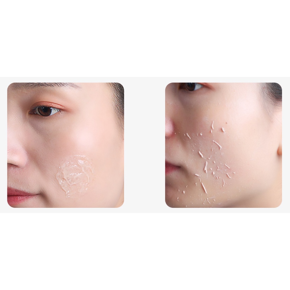 [Mã LT20 giảm 20K đơn 150K] Tẩy Tế Bào Chết Mặt Lenis Làm Sạch, Trắng Da, Loại Bỏ Cặn Bẩn Sâu Dưới Da - 100ML | BigBuy360 - bigbuy360.vn