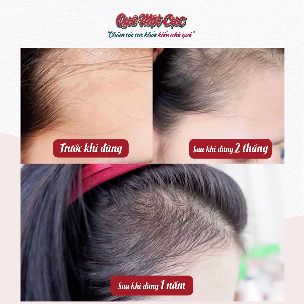 Xịt dưỡng tóc bưởi thơm ‍♀️Xịt bảo vệ tóc khỏi nhiệt, mềm mượt, dài khỏe, giảm rụng tóc QUÊ MỘT CỤC 100ml
