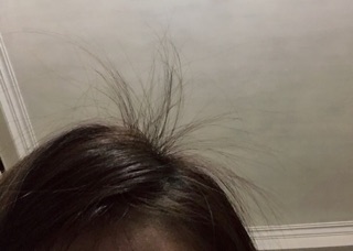 Combo kích mọc tóc