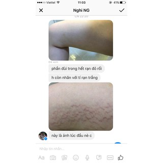 Dầu trị rạn Arganan (1 hộp)