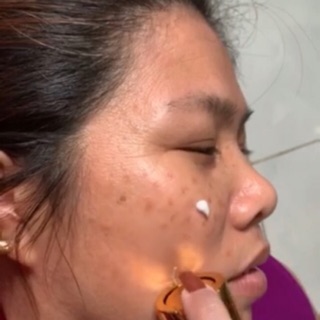 Thải độc cho da ( Detox Mask KH )