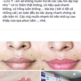 Son dưỡng chống thâm môi