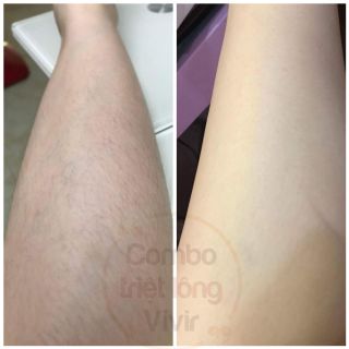 Combo triệt lông Wax + Mỡ trăn HANDMADE Vivir (tặng kèm bộ dụng cụ wax)