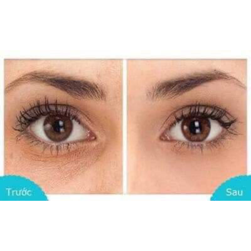 BILL ẢNH CUỐI_ CÓ SẴN KEM DƯỠNG MẮT CHỐNG LÃO HOÁ ROC RETINOL EYE CREAM | BigBuy360 - bigbuy360.vn