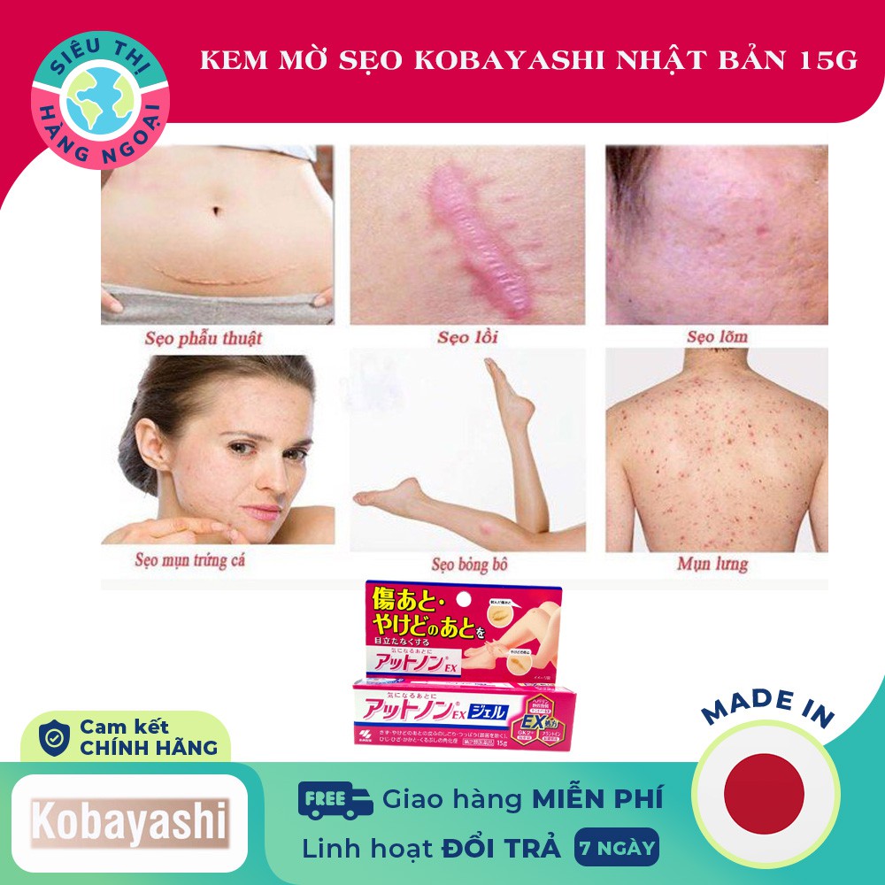 Kem mờ sẹo KOBAYASHI Nhật Bản 15g