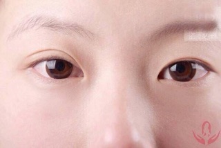 Keo Kích Mí Koji Eye Talk - Nhật