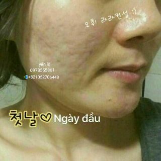 ❌❌COMBO 60 gói tinh chất vàng❌❌