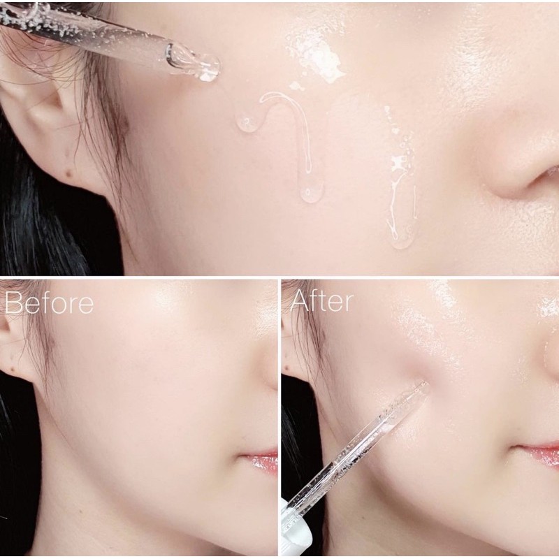 Tinh chất cấp nước phục hồi Torriden Dive-in Serum