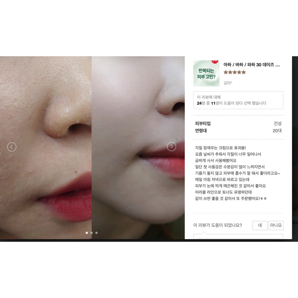 Bộ 3 món dưỡng da Some By Mi AHA- BHA-PHA 30 Days Miracle FULLSIZE | BigBuy360 - bigbuy360.vn