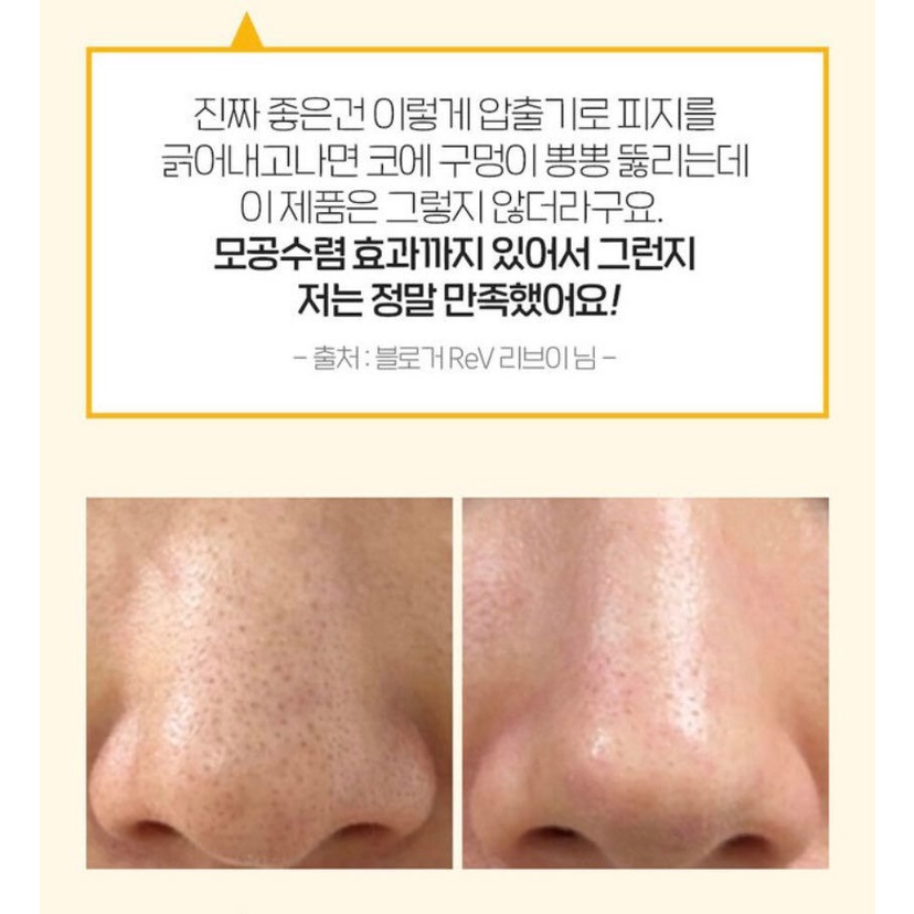 Ủ MỤN ĐẦU ĐEN MEDIPEEL