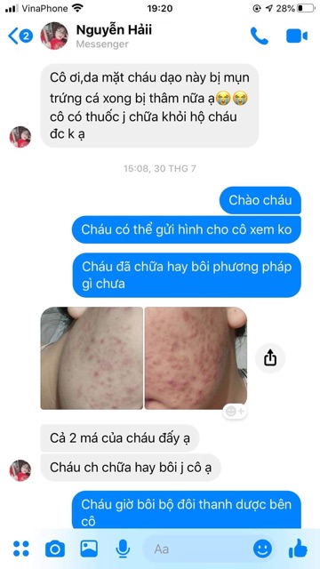 Serum thảo mộc LÁRE (THANH DƯỢC) 100% thiên nhiên | BigBuy360 - bigbuy360.vn