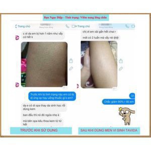 MEN VI SINH TAVIDA HẾT MỤN LƯNG, VIÊM NANG LÔNG, MẨN NGỨA