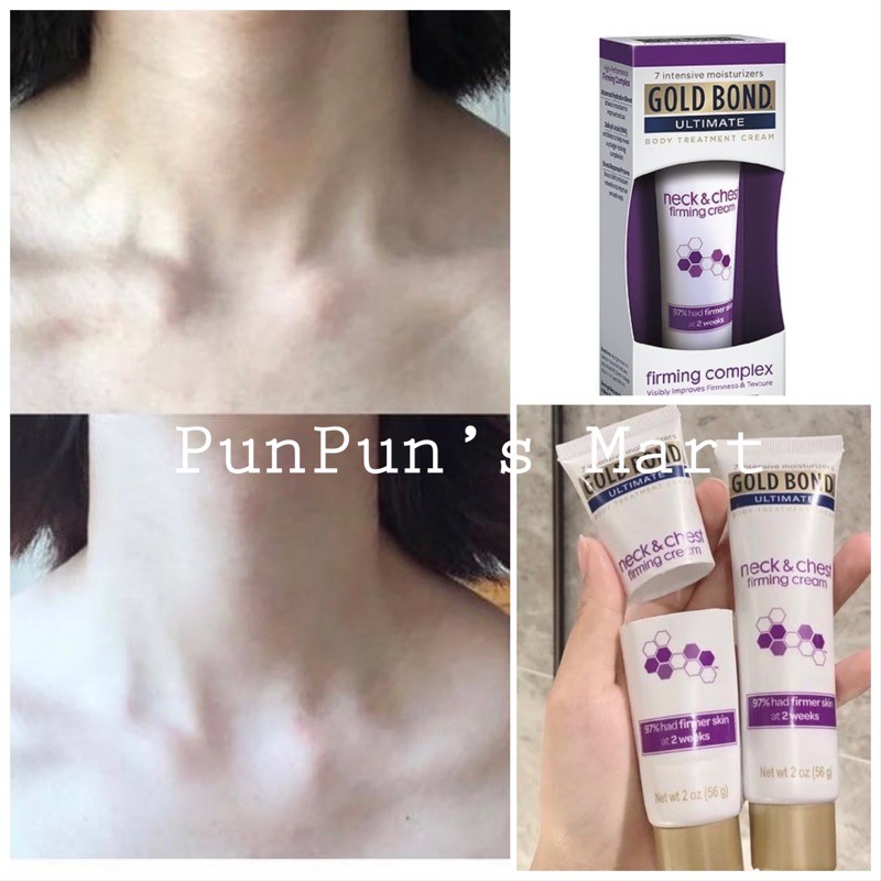 (HÀNG MỸ-AIR-BILL) Kem dưỡng cho vùng cổ & ngực GOLD BOND neck & chest