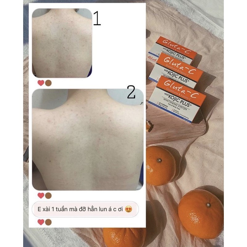 Xà phòng Gluta-C giảm mụn, mờ thâm sau mụn, hàng có sẵn giao ngay