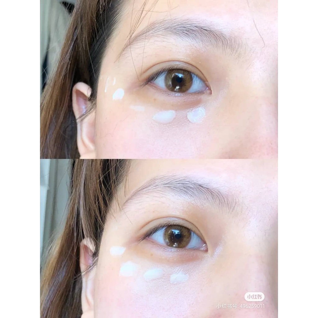 Kem mắt Coreana Hyaluron Shot Eye Cream dưỡng trắng mờ nhăn