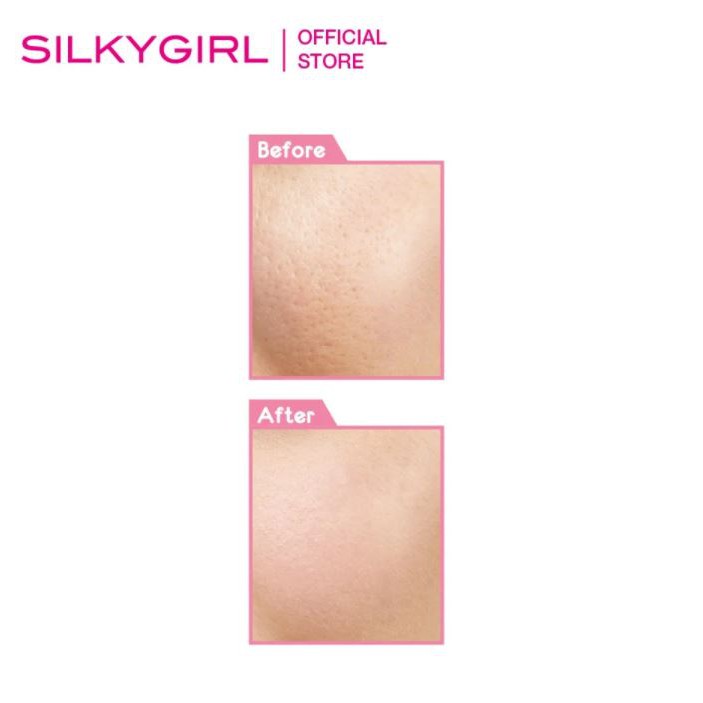 Kem Lót Trang Điểm Che Phủ Lỗ Chân Lông Cho Làn Da Mịn Màng Silkygirl Instant Pore Fix Primer 15ml