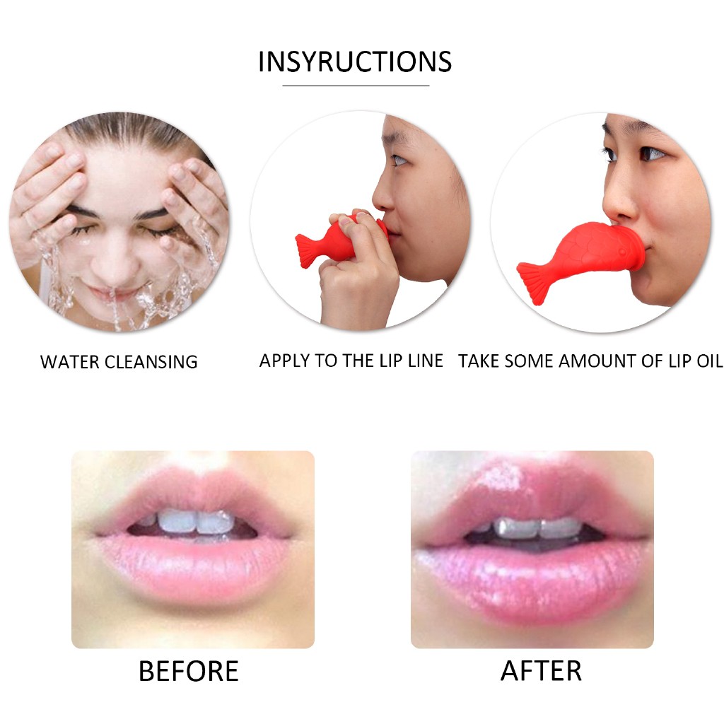 Dụng cụ làm đầy môi bằng silicone hình con cá
