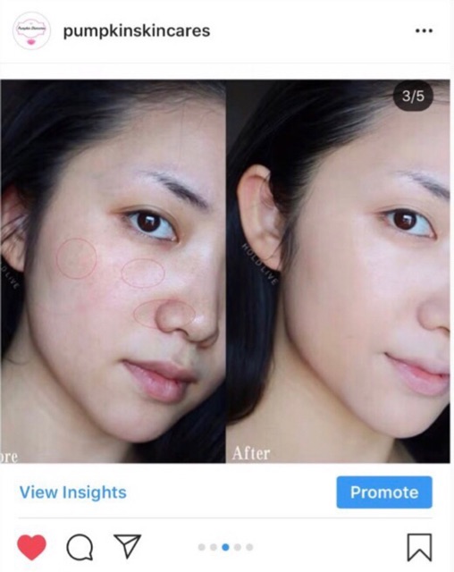 Bb cream Hold Live chính hãng dạng gói du lịch | BigBuy360 - bigbuy360.vn