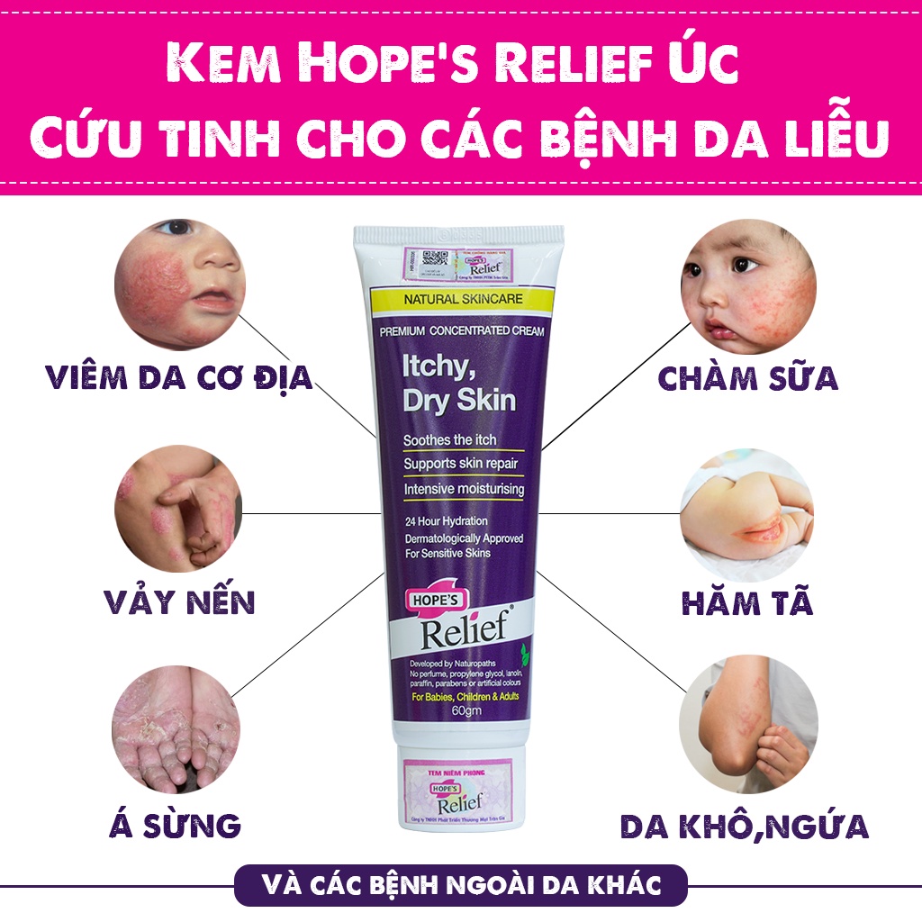 Kem đa năng thảo dược Hope's Relief Premium concentrated Cream Itchy 60g